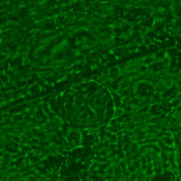 3. High-resolution holography onion cell 2 with nucleus This image was obtained without the use of an aperture. The cell wall and nucleus are clearly visible.