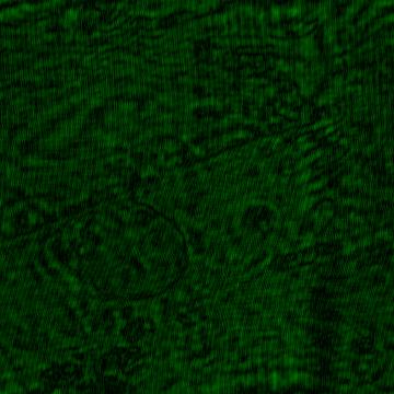Fig. 55, Amplitude Image (88 µm, 360 pixels per side) Onion cell with nucleus This image displays the wraparound effect