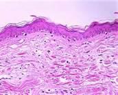 Dermal Epidermal Junction The point at which the epidermis & dermis meet Relies on the dermis for oxygen & nutrients Involved in inflammatory response mechanisms Constructed