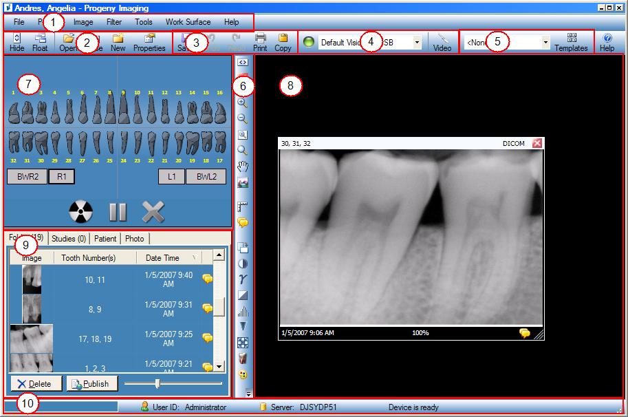 2 Overview Progeny Imaging Screen Layout Progeny Imaging s screen layout is divided into intuitive sections.