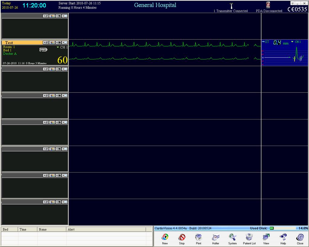3.6 If the recorder was set up properly, you should begin to see the real-time ECG in the row