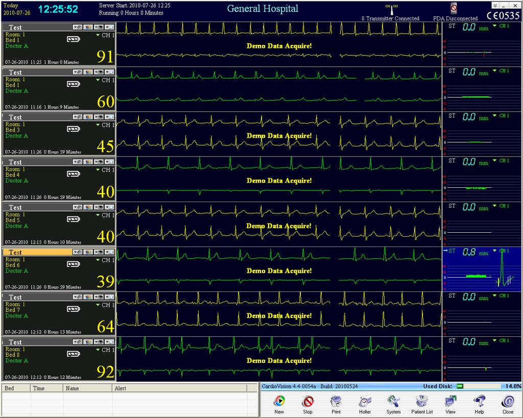 6.0 Detailed Operational Features of CardioVision 6.1 CardioVision 8-Patient Display: 1. Use two (2) separate monitors with each CardioVision (CV) system. 2.