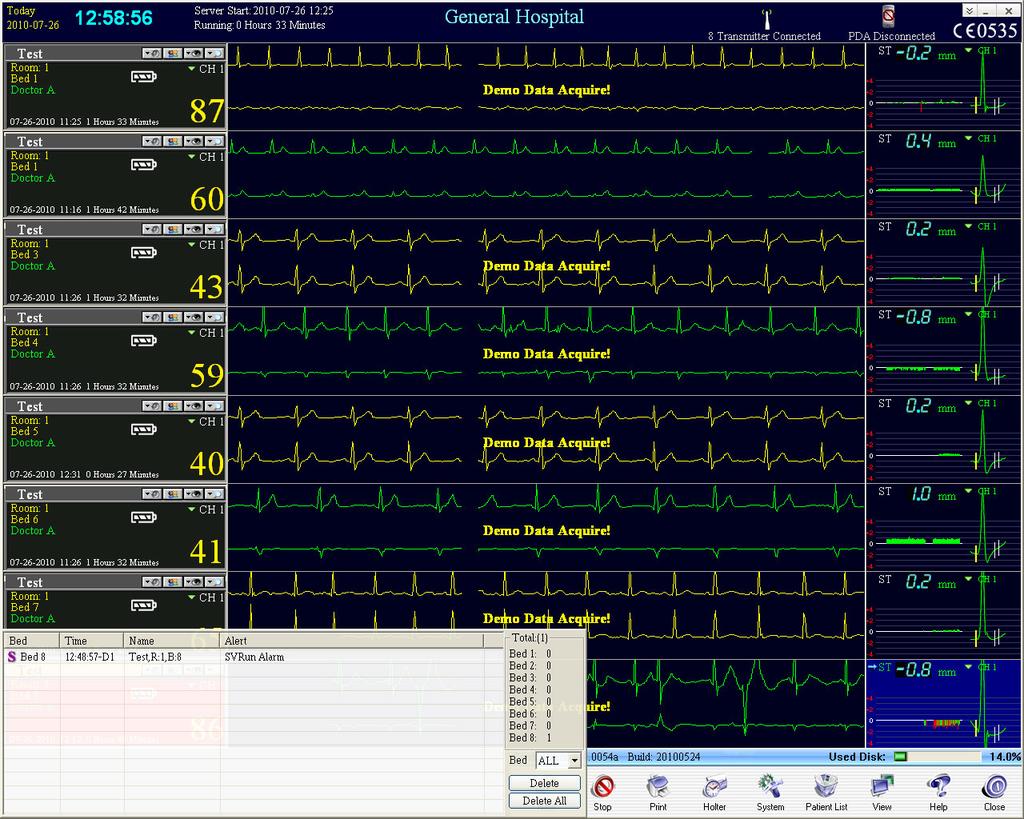 6.7 PDA for Remote Alerts and Bedside Monitoring 1. Alerts for patients are stored in the lower left section of this display. 2.