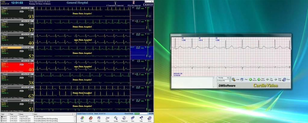 6.8 Dual Screen Displays for CardioVision 1. The above shows two (2) independent display monitors. 2. The Wi-Fi Wireless Real-Time ECG is shown for each patient on the left side monitor, 3.