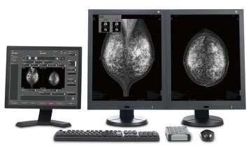High definition second monitor (3M/5M: Optional) Mood lighting to ease patient anxiety Warm indirect lighting is