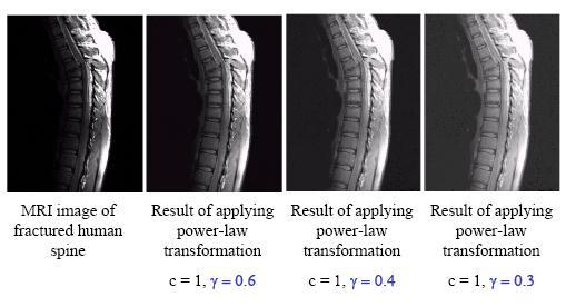 Power Law Transformation: Example The images shows the Magnetic Resonance