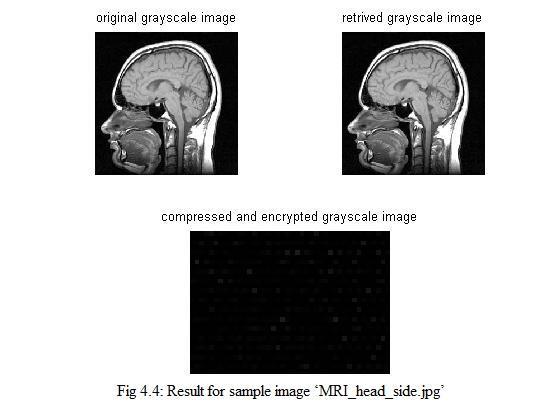 Here is another sample image which is a medical image and its corresponding outputs and the compression statistics has been shown below in figure 4.4 and table 4.4 respectively.