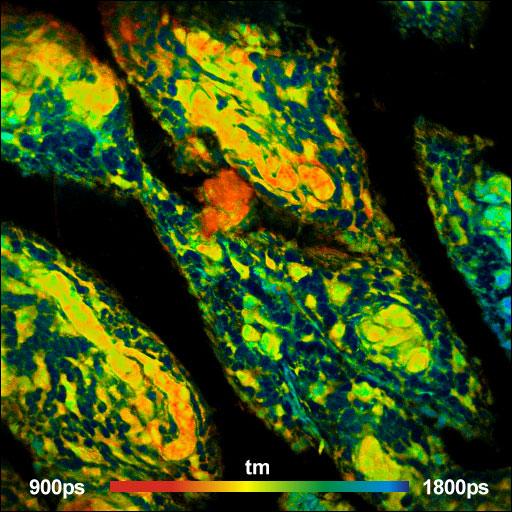 deep-tissue imaging capability Simultaneous, fully parallel detection in two