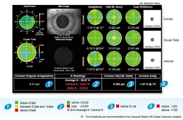 Página 4 de 9 Corneal Higher Order Aberration Index This index provides information on the potential visual outcome considering the aberration that cannot be corrected by an IOL.