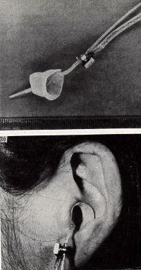 The ear canal An acoustic tube closed at