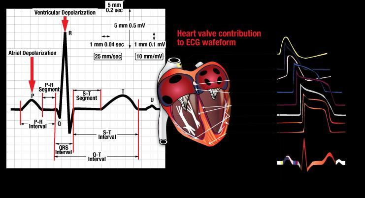 What is ECG?