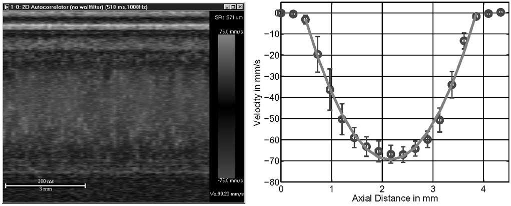 534 IEEE TRANSACTIONS ON INSTRUMENTATION AND MEASUREMENT, VOL. 53, NO. 2, APRIL 2004 Fig. 14. Left: Color M-mode image for steady Poiseuille flow.