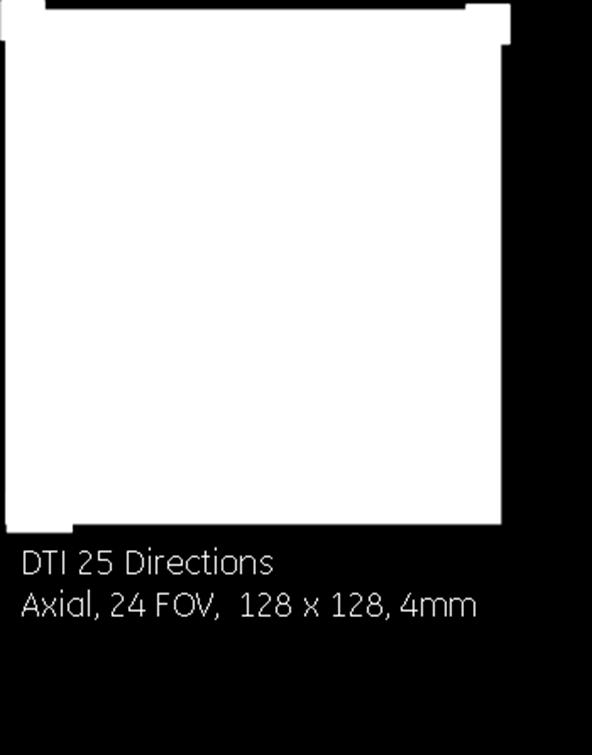 DWI 128 x 128, 4mm, b