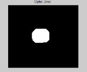 a regular grid spaced S pixels apart. V. OPTIC DISC SEGMENTATION The use of OD detection is not limited to glaucoma detection.