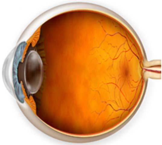 Optical Nerve Head Iris Lens