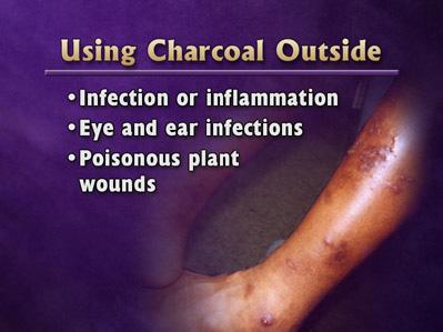 Wounds from poisonous plants 36 BrandX Pictures