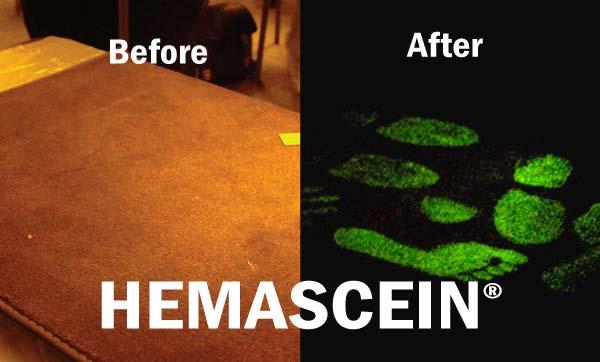 What is Hemascein TM The aqueous formulation of