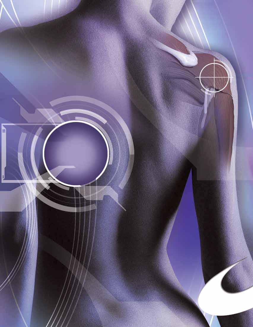Super Revo Shoulder Fixation System The Ideal Fixation Device For