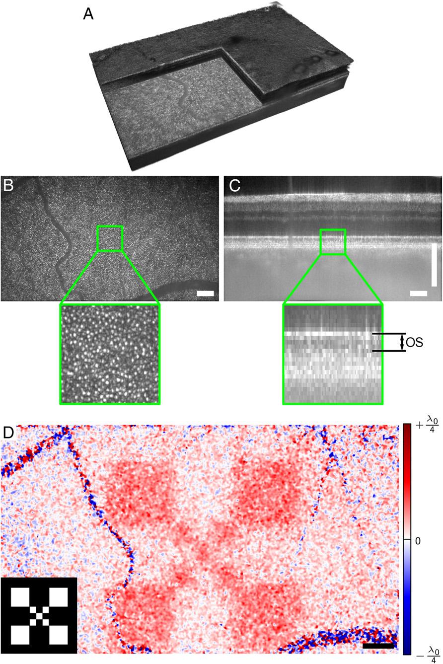 Fig. 2. Retinal imaging and response to an optical stimulus. (A) Volume of retina acquired by full-field swept-source OCT. (B) En face plane showing the backscattered intensity from the outer segment.