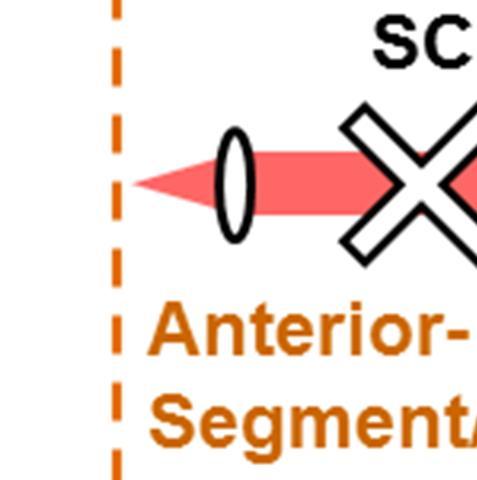 _ 8c Sample Arm Patient nterface SC 1 Anterior - Segment Full -Eye- Length nterface FT J Sc ox T i L _2 1 \ U S,H VTM RR 1 1