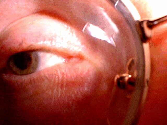 Pupil Sclera Iris The pupil opens (dilates) automatically in dim lighting