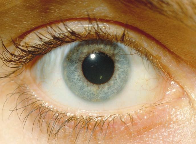 The cornea is made of cells that are transparent enough to let light pass through, yet tough enough to hold the eye together. Surrounding the cornea is an opaque tissue called the sclera.