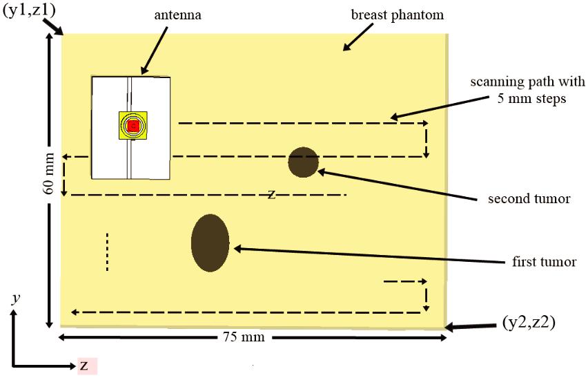Progress In Electromagnetics Research C, Vol. 79, 2017 11 z x (a) (b) (c) (d) Figure 11. (a) Microwave imaging setup of breast phantom with two tumors (Side view).