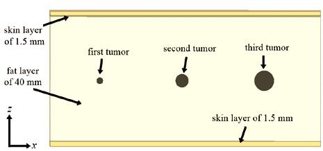 embedded tumor sizes was simulated. The breast parameters are the same as in the phantom used in Fig.