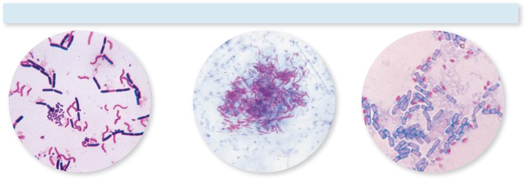 Differential Stains Differential Stains (a) Gram stain. Purple cells are gram-positive. Pink cells are gram-negative.