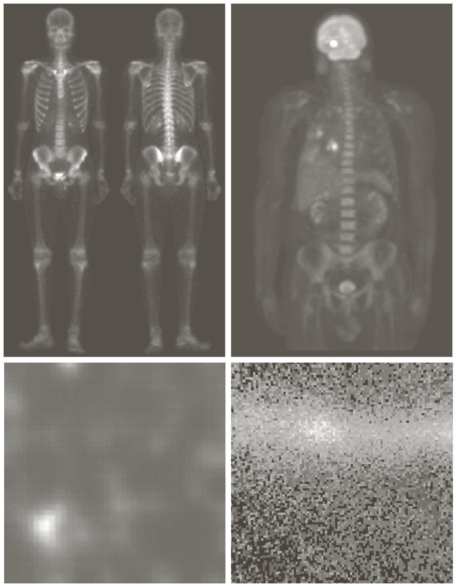 Gamma-ray imaging a c b d (a) gamma-ray imaging by radioactive isotope injection; (b) positron emission tomography (PET); (c)