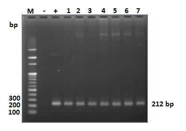 Kết quả điện di kiểm tra sản phẩm PCR trên gel agarose 2% (Hình 3.