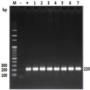 Ở thí nghiệm đối chứng âm không xuất hiện băng DNA nào, chứng tỏ kết quả PCR là đúng so với những tính toán lý thuyết. Hình 3.4.