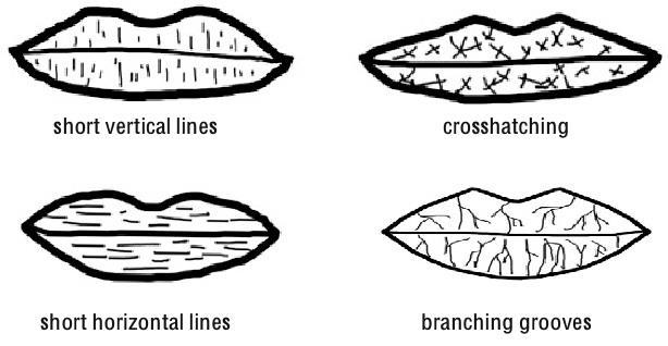 Other Prints Lips display several common patterns Short
