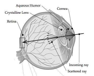 Ciliary corona and lenticular
