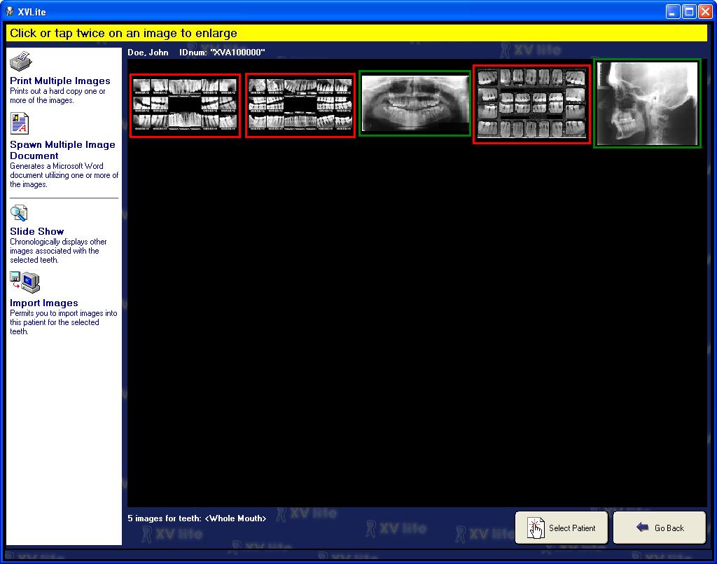 View All Images: Select View Images fr All Teeth. The wizard will prgress t display thumbnails f all images in patient s database. 2.5.