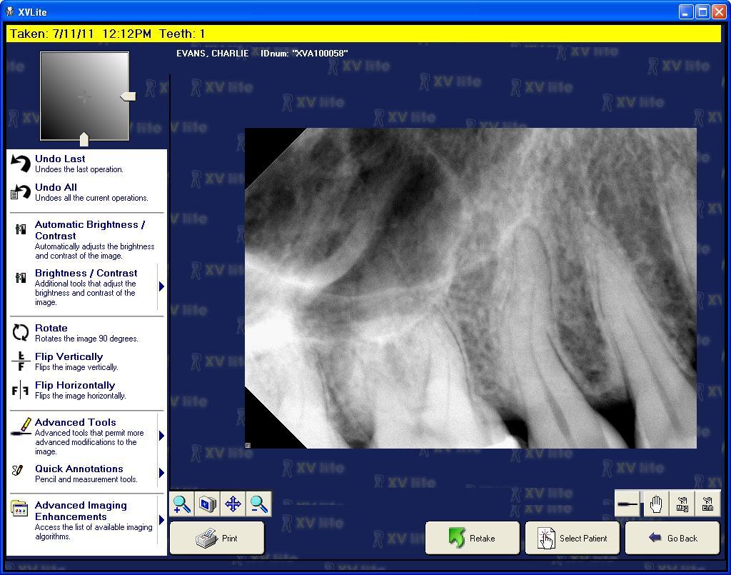 The amunt f time it takes fr the image t appear n the screen is dependent upn the sensr manufacturer. 3.1.8 The image file is autmatically saved and stred in the patient s file. 3.1.9 Pst-capture enhancements can be applied t the newly captured image.