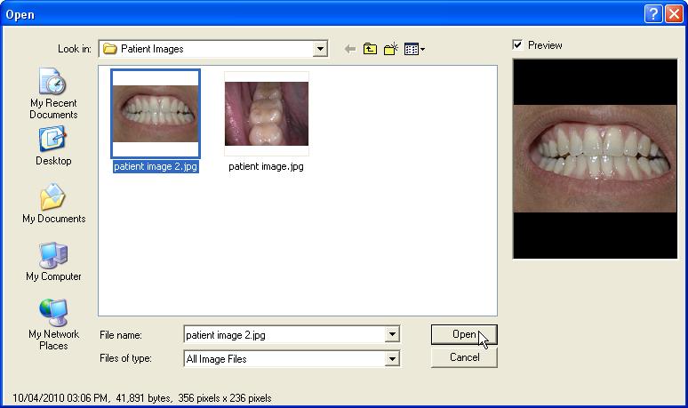 10.1.4 A screen displaying thumbnails f the patient s images displays. Select Imprt Images. 10.1.5 The Open dialg bx will display.