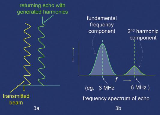 Brian Starkoff Figure 3: Transmitted and reflected wave shapes (3a) and a graph showing the frequency spread in returning echoes from a 3 MHz pulse (3b).