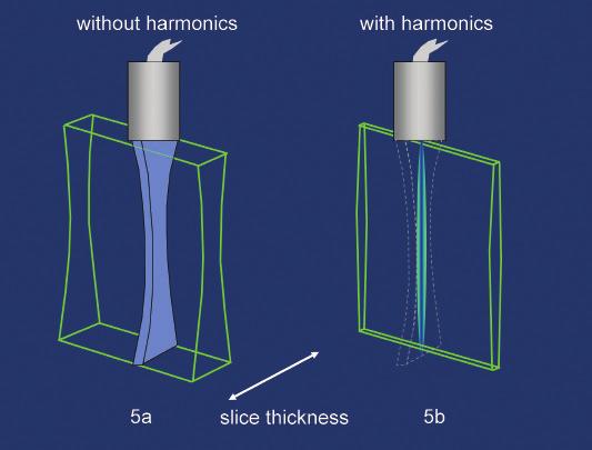 Ultrasound physical principles in today s technology Figure 5: An ultrasound beam is much thicker in the orthogonal plane than in the scan plane which results in a relatively large slice thickness