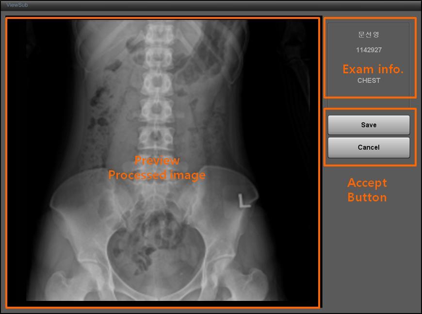 After X-ray exposure, you can see the image as upper figure.