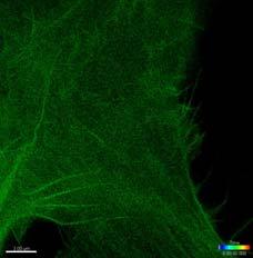 resolution to be achieved Confocal laser scanning microscopy In vivo
