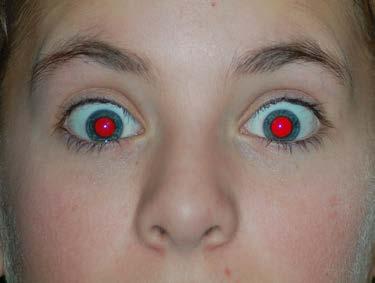 Not possession by demonic spirits Flash red-eye reduction