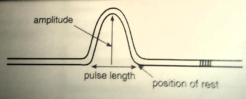Amplitude: Maximum displacement of a particle from its position of rest