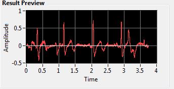 TABLE 1 ECG Recordings Amplitude Difference (mv) ECG Machine Using the Module Lead 1 P 0.2 0.2 R->S 0.55 0.53 T 0.3 0.