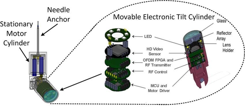 MARVEL: Miniature Advanced Remote Videoscope for Expedited Laparoscopy MARVEL: A wirelessly controlled and communicating high-definition video system that provides the visual advantages of