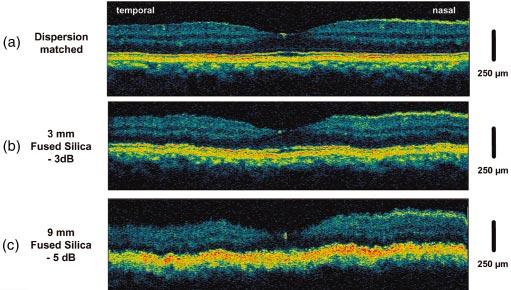 Drexler Fig. 6 Effect of dispersion mismatch in in vivo ultrahigh-resolution retinal imaging. (a) Dispersion matched.