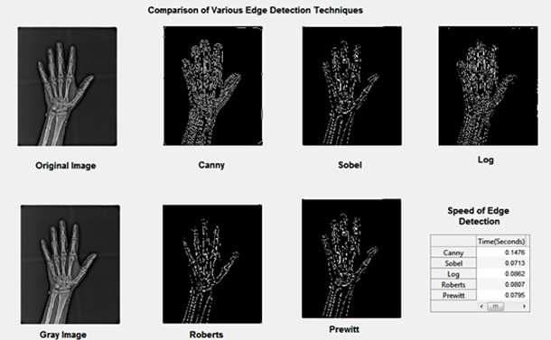 Figure 12 Screen shots for various edge detection algorithms Figure 8 shows that implementation screen shots for various filters over Salt and Pepper noise, Figure 9 shows that implementation screen