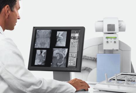 Streamline your workflow Available almost instantely: Radiographic images and fluoroscopic sequences in one patient folder Procedure time: without Luminos drf with Luminos drf Streamline your