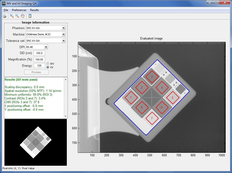 DoseLab MV and kv QA Analysis 1 image/imaging energy (2 total) MV/kV phantoms