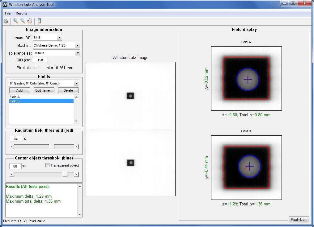 CBCT Positioning 2 EPID images after CBCT positioning WL-QA phantom Many ways to accomplish